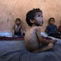 ‘Famine’, ‘starvation’: the challenges in defining Gaza’s plight | National